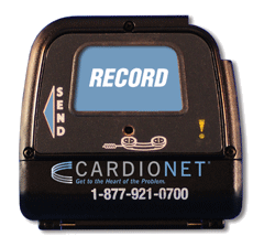 auto detect looping event monitor from cardionet