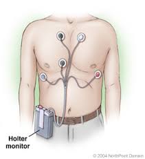 Holter monitorr diagram
