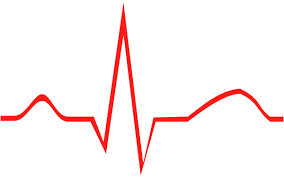 ECG Arrhythmia Guide