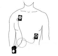 Cardiac Event Monitoring Diagram