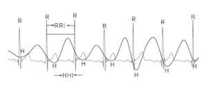 heart rate variability hrv monitoring