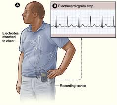 patient wearing cardiac monitor