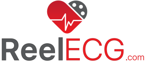 ReelECCG Cardiac Monitors AECG